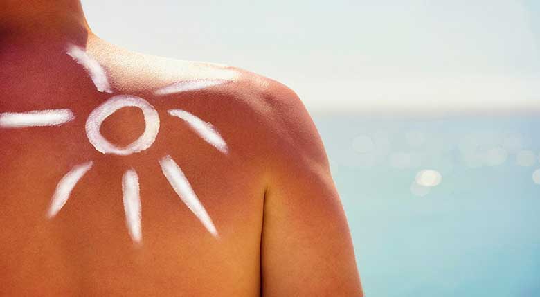 The effects of Argan Oil on burns